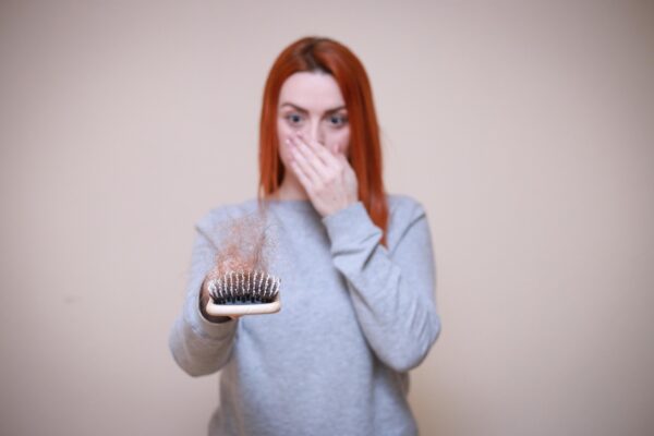 hair loss, hair, old, balding, people, grown-up, loss, bald, hair treatment, hair loss, hair loss, hair loss, hair loss, hair loss